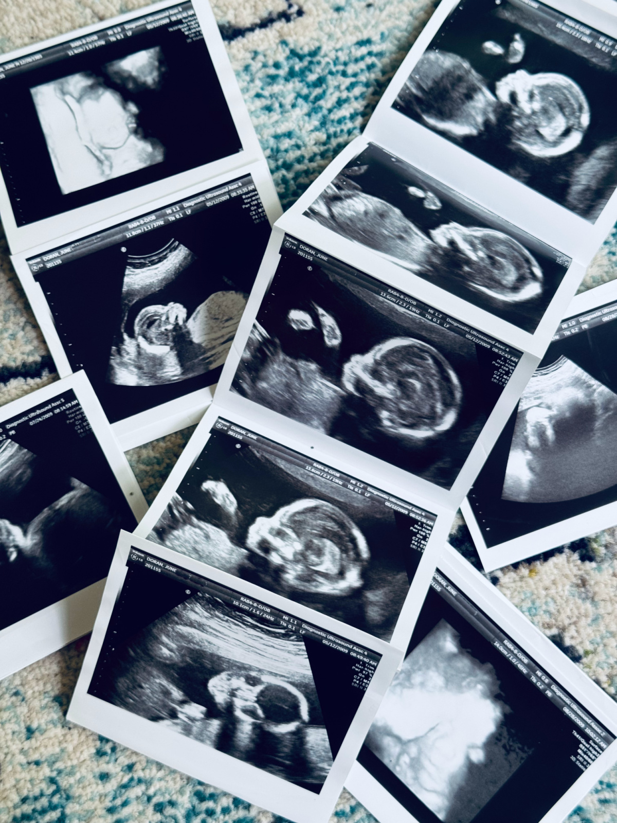 ultrasound photos on carpet.